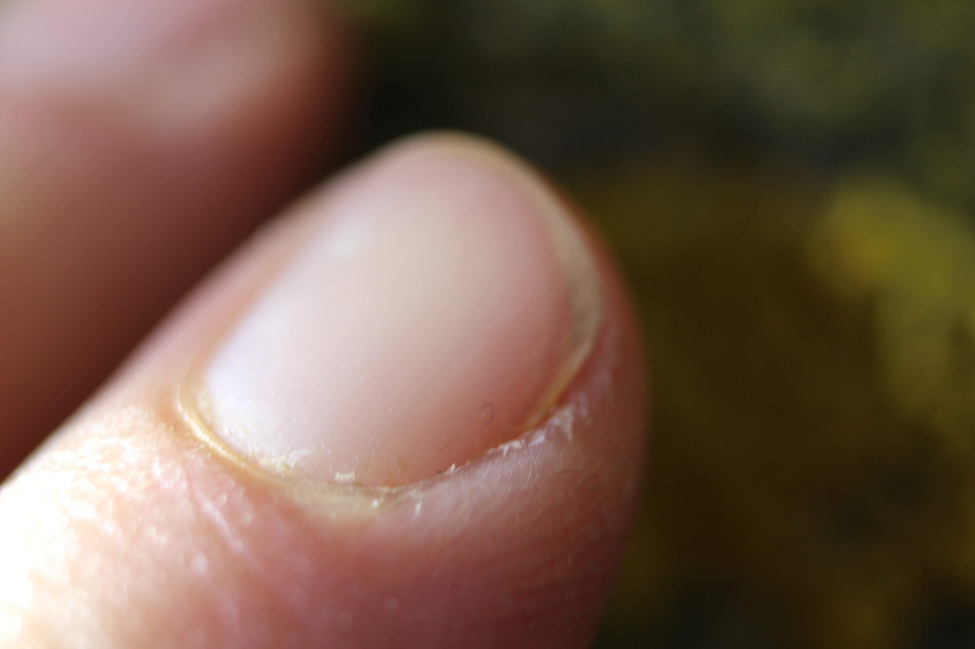 Ongle