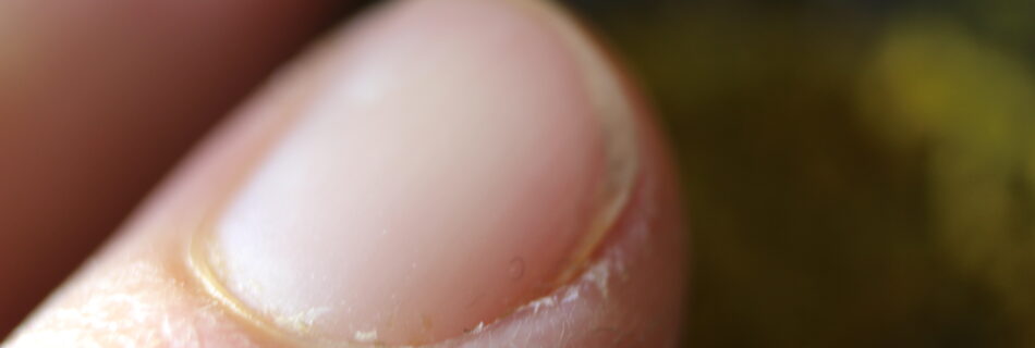 Ongle